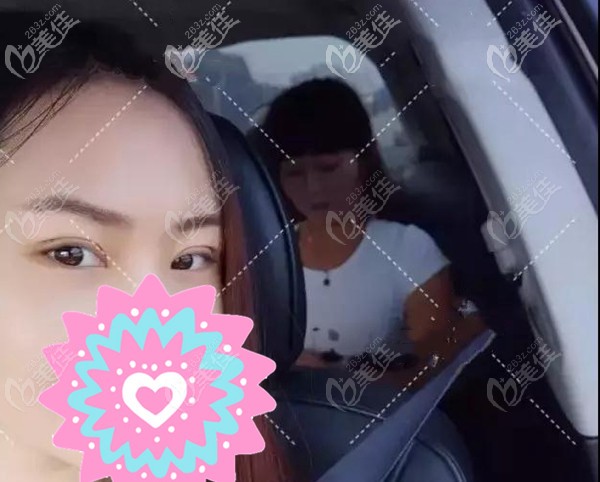 潮州韓美整形醫(yī)院全切雙眼皮案例(內(nèi)含雙眼皮恢復(fù)過程圖 一個月)