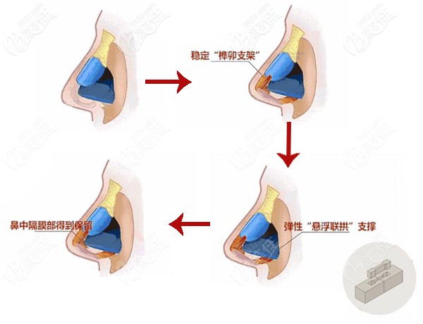 榫卯結(jié)構(gòu)鼻子支架圖 榫卯結(jié)構(gòu)鼻子支架圖