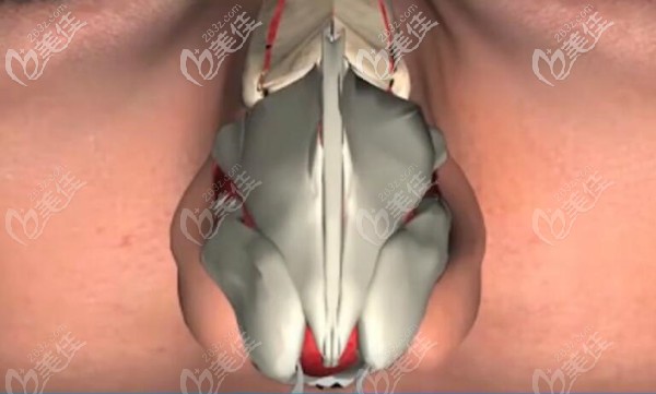 鼻骨內(nèi)推后的效果