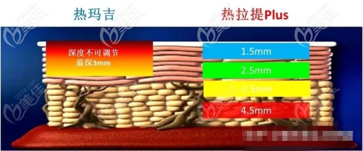 熱瑪吉和熱拉提plus的作用深度不同
