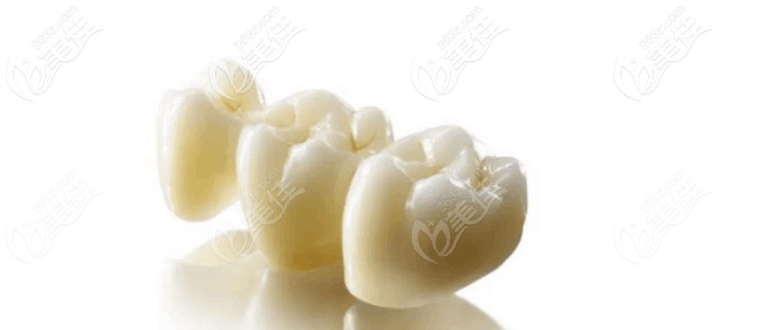 二氧化鋯全瓷牙 二氧化鋯全瓷牙