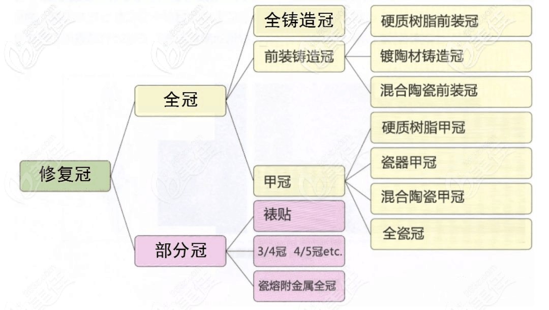 牙冠修復(fù)的種類 牙冠修復(fù)的種類