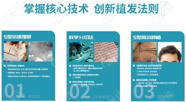西安沐森速倍植發(fā)優(yōu)勢 西安沐森速倍植發(fā)優(yōu)勢
