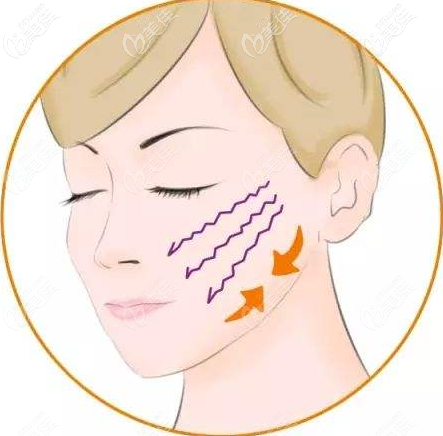 v美減齡v3是怎樣做的