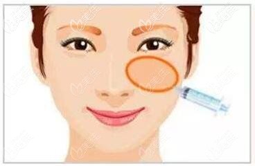 注射填充蘋果肌用瑞藍和伊婉c玻尿酸哪個比較好？