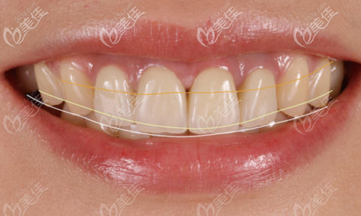 茅來發(fā)注重微笑設(shè)計理念