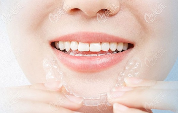 廈門峰煜口腔隱適美牙齒矯正器