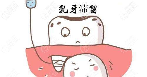 乳牙不拔對(duì)恒牙的影響