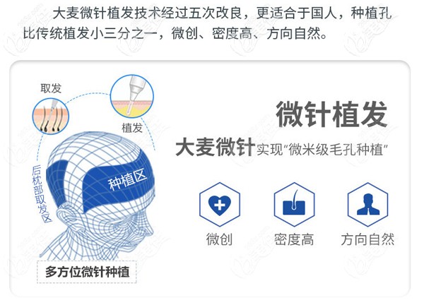 <!--<i data=20240703-sp></i>-->微針植發(fā)技術(shù)優(yōu)勢 <!--<i data=20240703-sp></i>-->微針植發(fā)技術(shù)優(yōu)勢