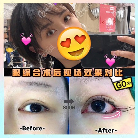 點這看銅陵晶美的眼綜合修復(fù)真人案例，三組不同眼部問題的效果圖都有哦