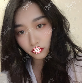 我原來的眼睛 我原來的眼睛