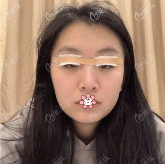 手術(shù)后第二天 手術(shù)后第二天