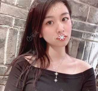 兩個(gè)月后 兩個(gè)月后