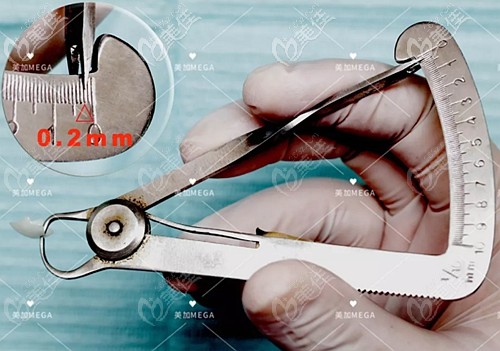 美加瓷貼面的厚度