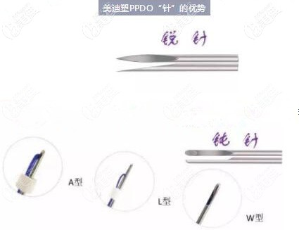 美迪塑埋線針的優(yōu)勢 美迪塑埋線針的優(yōu)勢