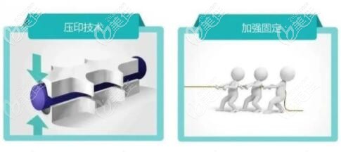 秘特埋植線3D立體壓印技術(shù)優(yōu)勢 秘特埋植線3D立體壓印技術(shù)優(yōu)勢