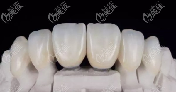 日本則武氧化鋯全瓷牙 日本則武氧化鋯全瓷牙