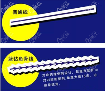 對(duì)稱鈍緣倒刺設(shè)計(jì)