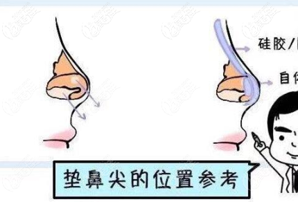 墊鼻尖的位置