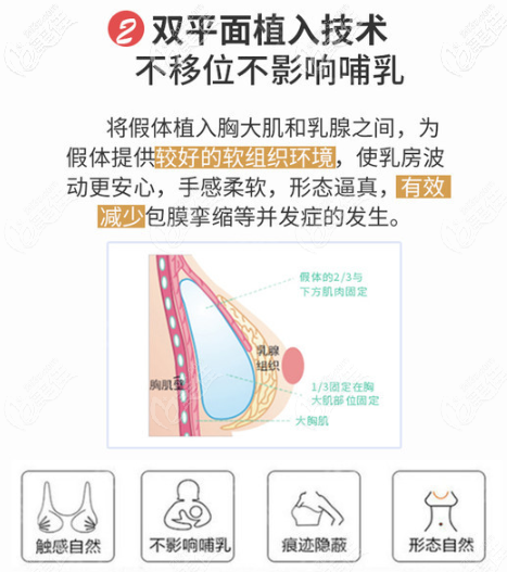 曲梅醫(yī)生做胸部整形的優(yōu)勢(shì) 曲梅醫(yī)生做胸部整形的優(yōu)勢(shì)