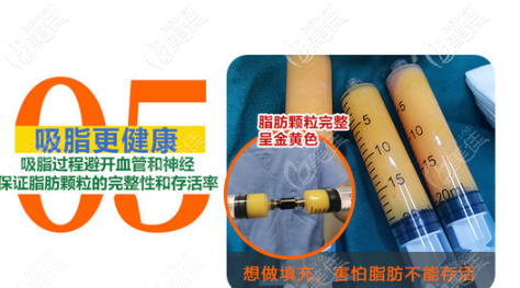 劉昆鵬醫(yī)生做吸脂的優(yōu)勢(shì) 劉昆鵬醫(yī)生做吸脂的優(yōu)勢(shì)