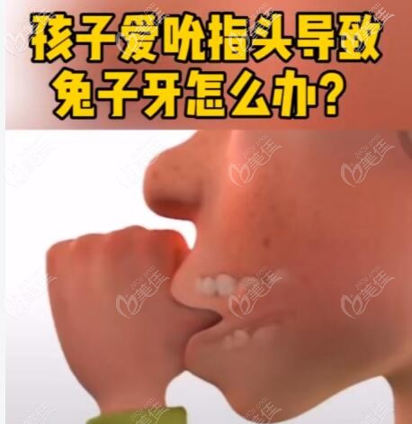 導(dǎo)致門牙外凸的原因