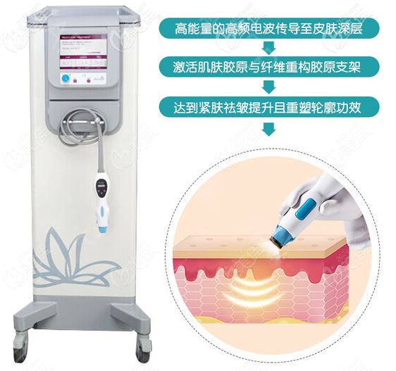 中山做熱瑪吉多少錢?中山韓妃整形醫(yī)院年終優(yōu)惠面部熱瑪吉8800元起