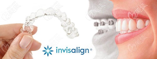 隱適美的優(yōu)勢