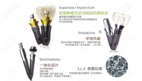 登騰種植牙的優(yōu)勢(shì)
