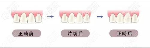 什么是片切 什么是片切