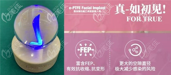 初真膨體富含F(xiàn)EP+纖維結(jié)的存在