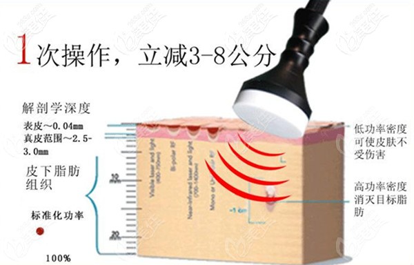 隔空爆脂儀溶脂原理