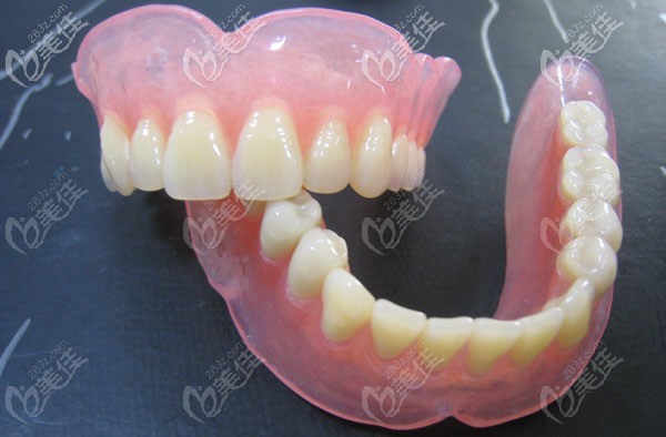 日本松風塑鋼牙示意圖 日本松風塑鋼牙示意圖