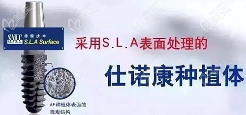 韓國(guó)仕諾康種植體的型號(hào)