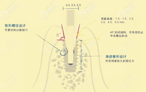 韓國(guó)仕諾康種植體好不好