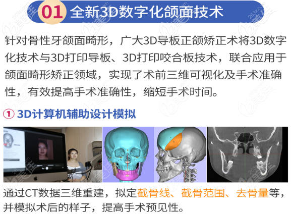 數字化導板正頜多少錢?3d導板正頜和普通正頜手術有什么區(qū)別