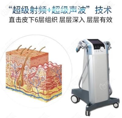 英國BTL超級射頻溶脂