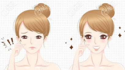 雙眼皮動畫圖示