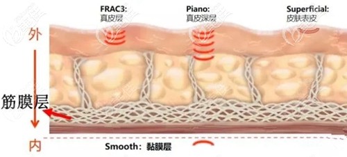 福州名韓Fotona 4D Pro治療深入層次