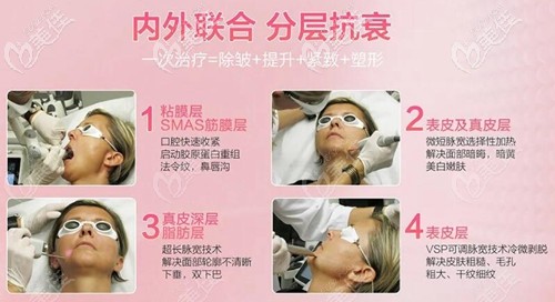 福州名韓Fotona 4D Pro治療過程