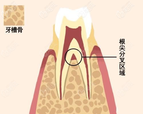 未成年人牙槽骨還在生長