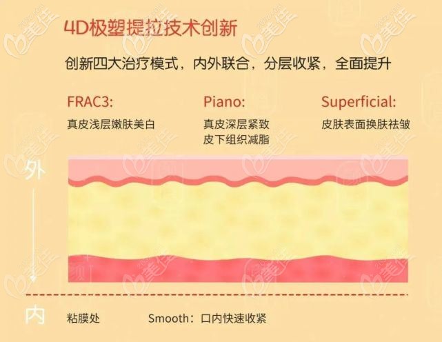 Fotona4D的不同功效