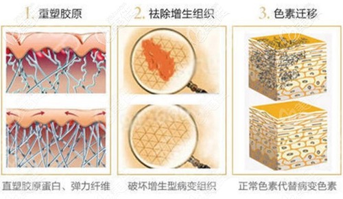寧波美萊多維祛疤系統(tǒng) 寧波美萊多維祛疤系統(tǒng)