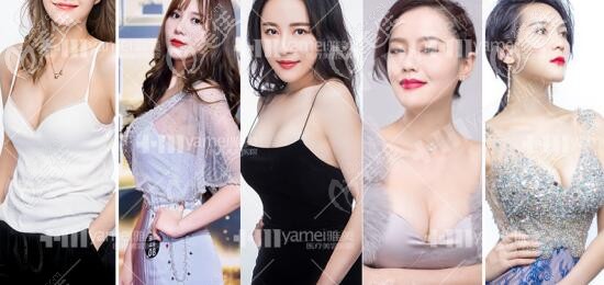 長沙雅美假體隆胸真人案例