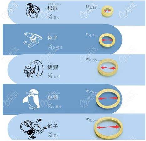 牙齒正畸矯正圖案 牙齒正畸矯正圖案