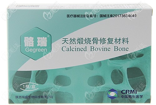 骼瑞骨粉的優(yōu)勢