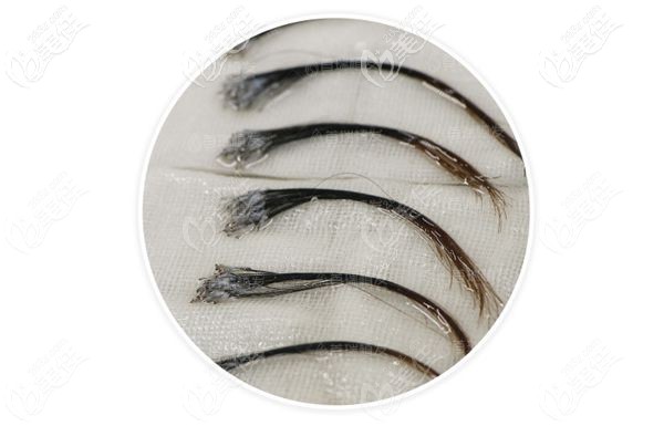 成都首瑞不剃發(fā)長(zhǎng)發(fā)種植