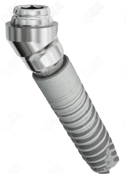 德國AnkyLos種植體優(yōu)勢