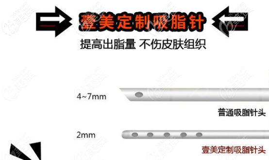 煙臺(tái)壹美天成吸脂優(yōu)勢(shì)