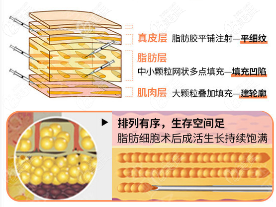 深圳南雅整形<!--<i data=20240703-sp></i>-->杰醫(yī)生吸脂優(yōu)勢 深圳南雅整形<!--<i data=20240703-sp></i>-->杰醫(yī)生吸脂優(yōu)勢
